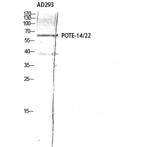 POTEG Antibody (150-230 aa, Internal)