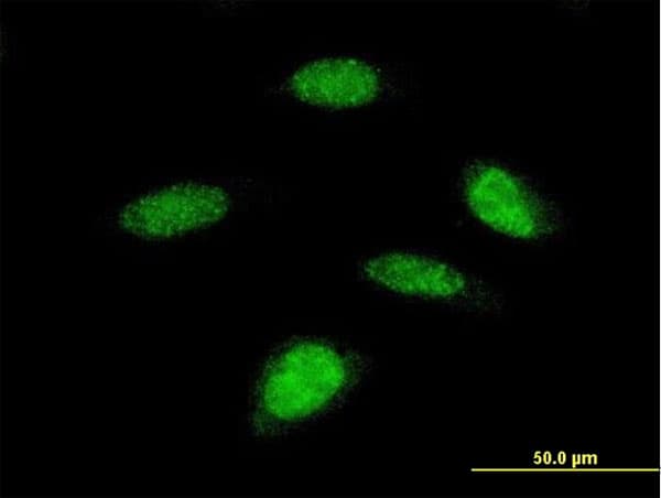 IHC-plus™ RPS6KB2 / S6K2 Antibody (clone 4B11)