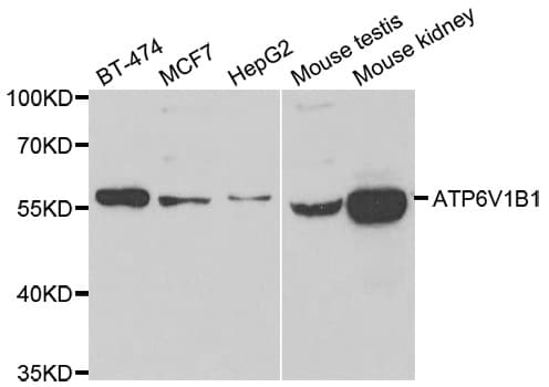 ATP6V1B1 Antibody