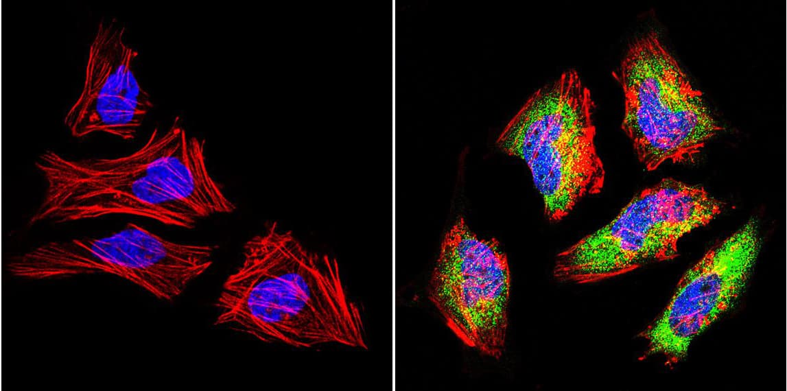 IHC-plus™ Polyclonal Rabbit anti-Human LIN28A / LIN28 Antibody (IHC, IF, WB)