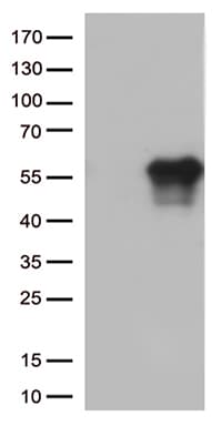 HAVCR2 / TIM-3 Antibody (clone OTI1G9, Carrier-free)