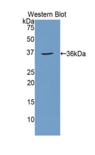 CA12 / Carbonic Anhydrase XII Antibody (aa25-302, PE)