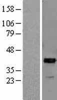 ARG2 / Arginase 2 Protein (Over-Expression Lysate Myc-DDK (Flag))