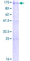 Human USP33 / VDU1 Protein (Recombinant GST)