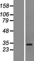 CHCHD6 Protein (Over-Expression Lysate Myc-DDK (Flag))