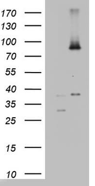 Monoclonal Mouse anti-Human ALDP / ABCD1 Antibody (clone OTI2C12, aa508-745, IHC, WB)