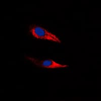 IHC-plus™ ADGRF5 / GPR116 Antibody (N-Terminus)