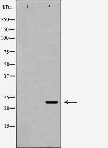 Polyclonal Rabbit anti-Human RAB7A / RAB7 Antibody (IHC, WB)