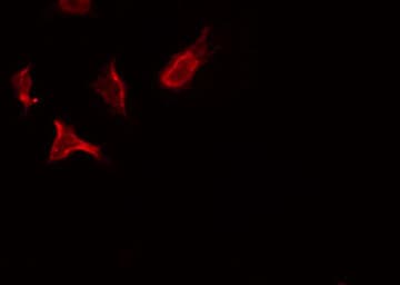 STK10 / LOK Antibody