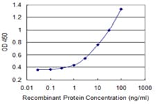 PFKM / PFK-1 Antibody (clone 1D1)