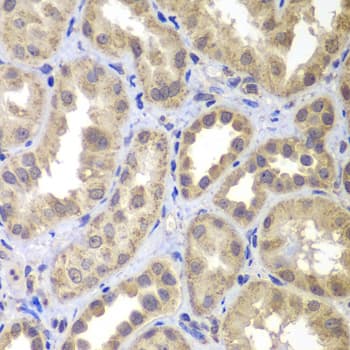 MAP2K4 / MKK4 Antibody (AP)