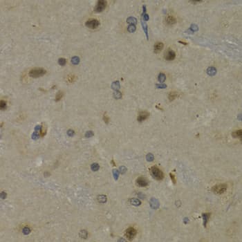 Polyclonal Rabbit anti-Human MAX Antibody (IHC, IF, WB)