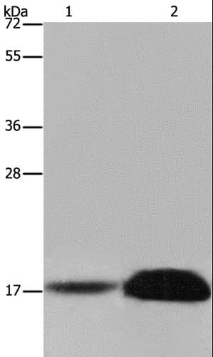 FHIT Antibody