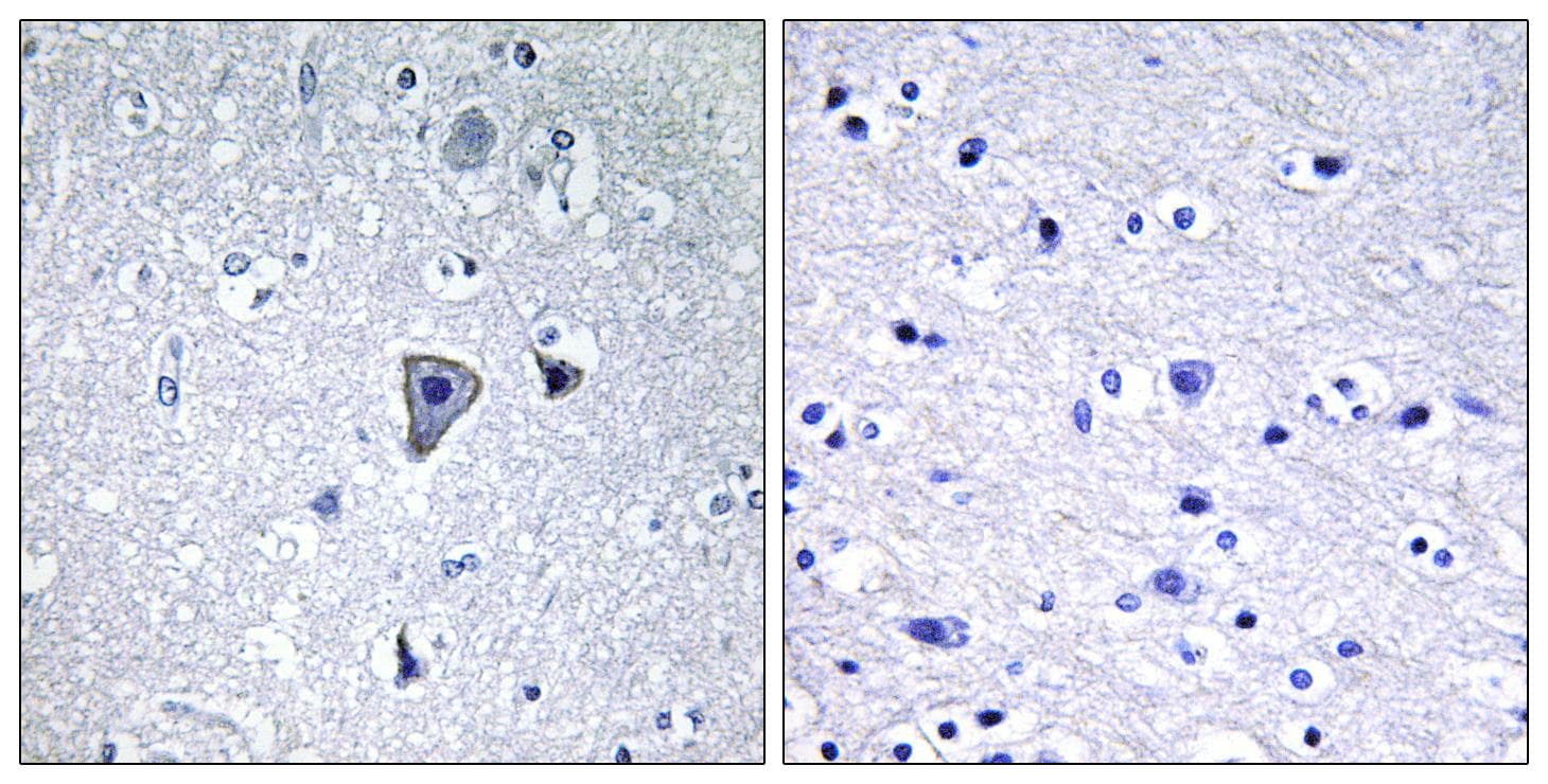 Polyclonal Rabbit anti-Human GRM1 / MGLUR1 Antibody (IHC)