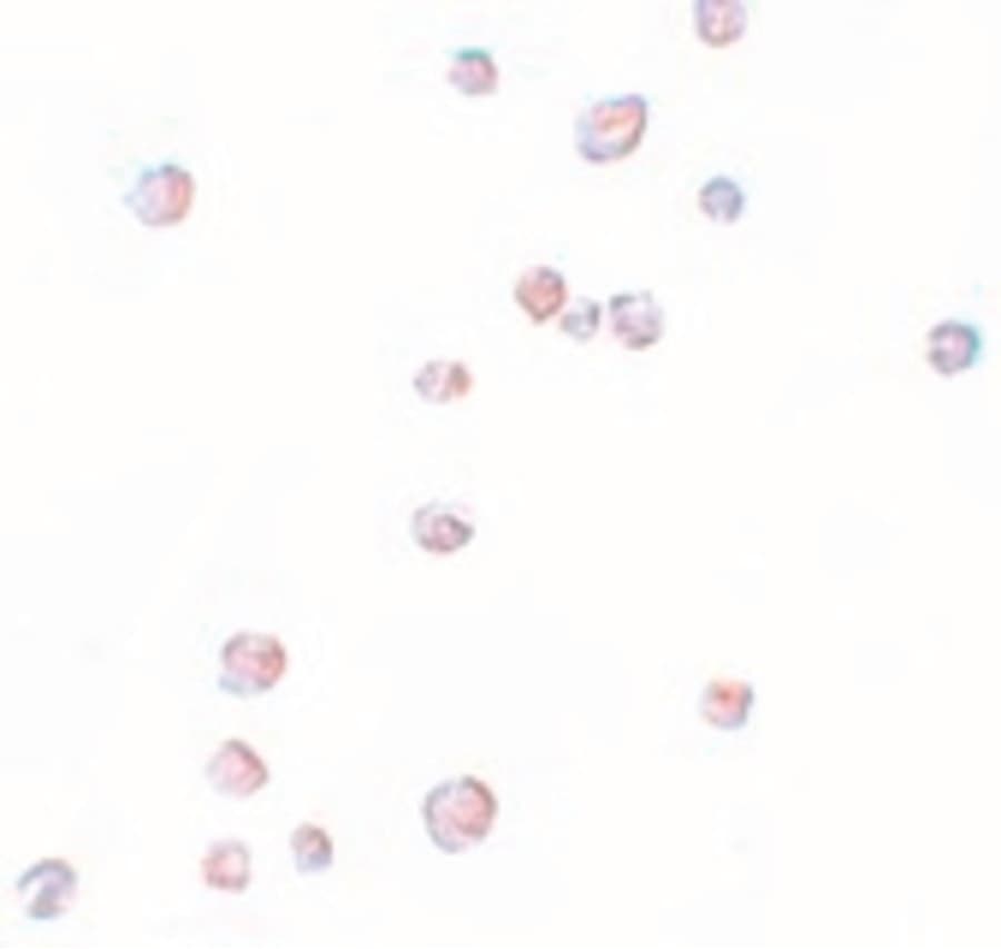 IHC-plus™ Polyclonal Rabbit anti-Human CHORDC1 / CHP1 Antibody (IHC, IF, WB)