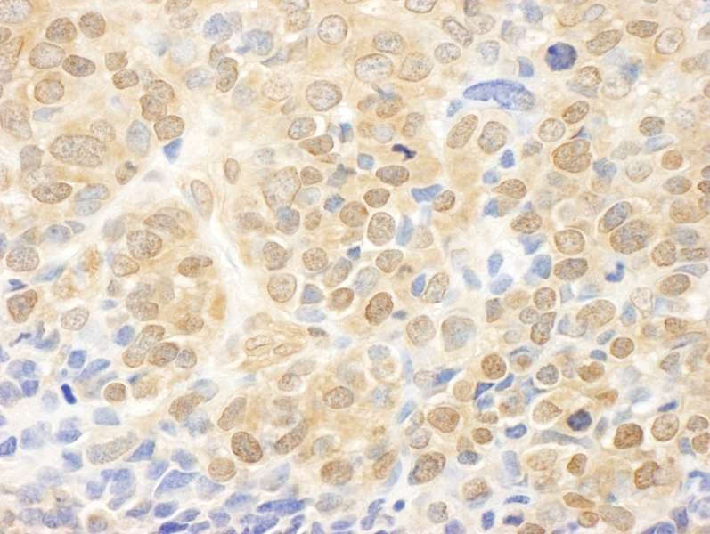 MAP2K1 / MKK1 / MEK1 Antibody (aa343-393)