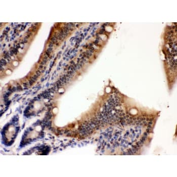 PDPK1 / PDK1 Antibody (aa524-556)
