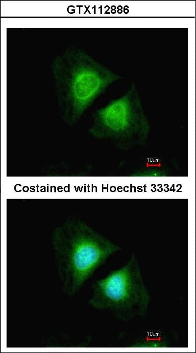 PathPlus™ CANX / Calnexin Antibody