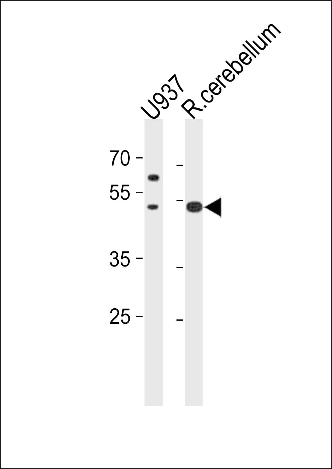 SLC25A25 Antibody (aa63-93)
