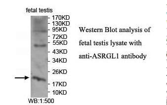 Polyclonal Rabbit anti-Human ASRGL1 Antibody (aa2-180, IHC, WB)