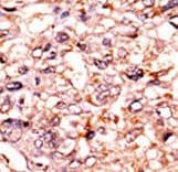 TP53 / p53 Antibody (phospho-Ser315)