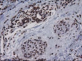 CTDSP1 / SCP1 Antibody (clone OTI1B6)