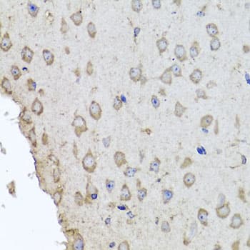 Polyclonal Rabbit anti-Human HBA1+2 / Hemoglobin Alpha Antibody (IHC, WB)