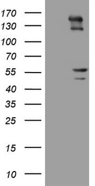Peripherin Antibody (clone OTI7E4)