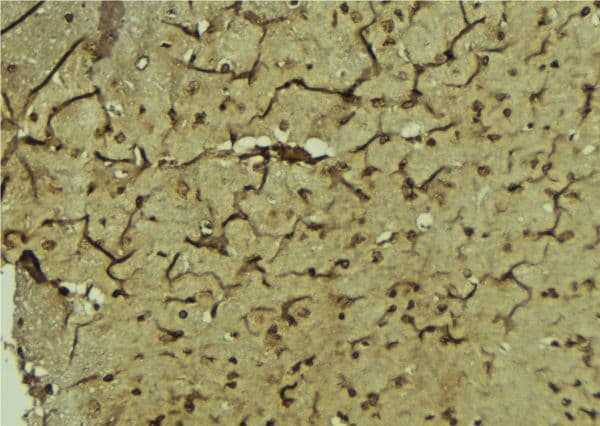 PAX3 Antibody
