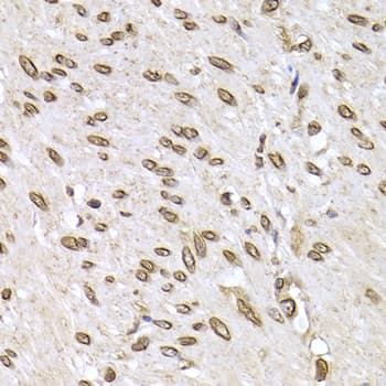 LAMB2 / Laminin Beta 2 Antibody