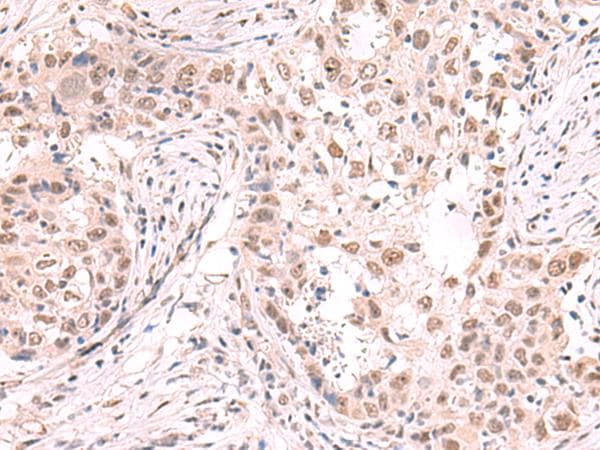 ZNF559 Antibody