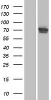 USHBP1 Protein (Over-Expression Lysate Myc-DDK (Flag))