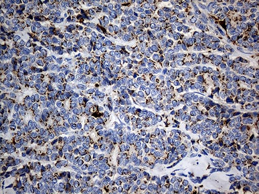 PTPN22 / PEP Antibody (aa359-449, clone OTI6B1)