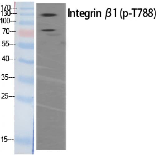 Polyclonal Rabbit anti-Human ITGB1 / Integrin Beta 1 / CD29 Antibody (720-800 aa, IHC, WB)