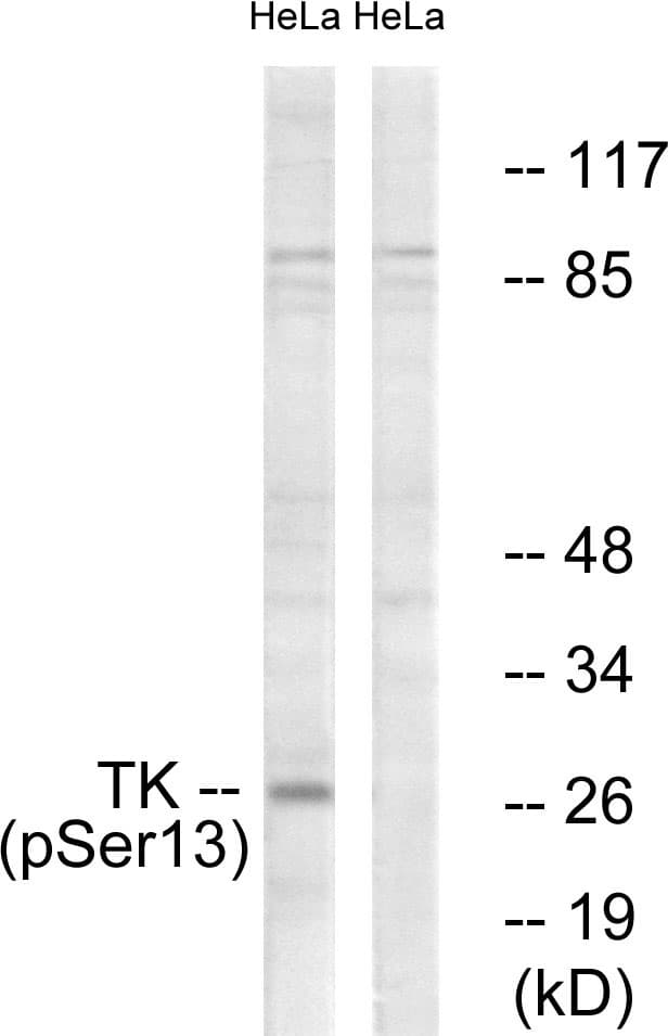 TK1 / TK / Thymidine Kinase Antibody (phospho-Ser13)