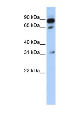 ABCD4 Antibody (aa108-157)