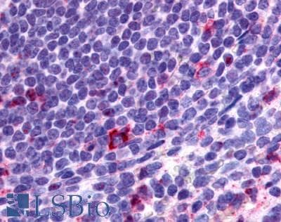 IHC-plus™ Polyclonal Rabbit anti-Human CCR2 Antibody (N-Terminus, IHC)
