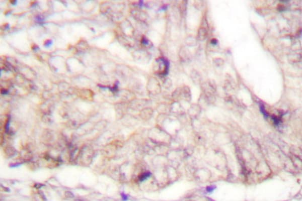 Polyclonal Rabbit anti-Human ATRIP Antibody (Asp64, IHC, IF, WB)