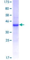 Human IL13RA2 / IL13R Alpha 2 Protein (Recombinant GST, N-terminus)