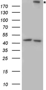 ITGB4 / Integrin Beta 4 Antibody