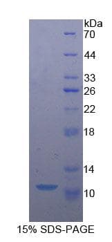 Human CASP9 / Caspase 9 Protein (Recombinant His)
