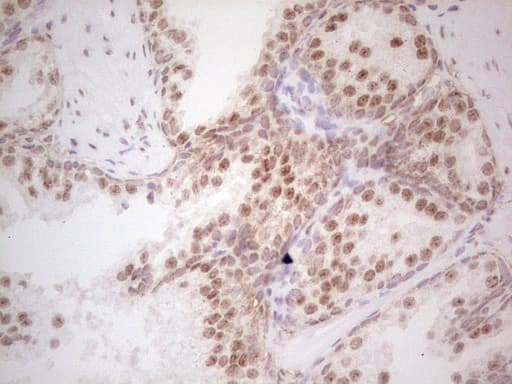 RARA / RAR Alpha Antibody (aa52-299, clone OTI2C3)
