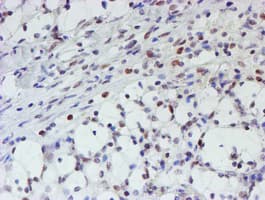 MLF1 Antibody (clone OTI5D9)