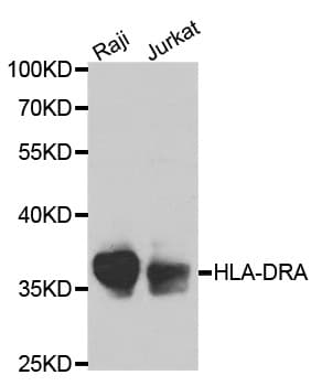 PathPlus™ Polyclonal Rabbit anti-Human HLA-DRA Antibody (IHC, WB)