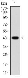 IHC-plus™ PRKAG1 / AMPK Gamma 1 Antibody (aa230-331, clone 7H3E9)