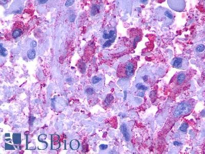 PathPlus™ C5AR2 / GPR77 / C5L2 Antibody (C-Terminus)