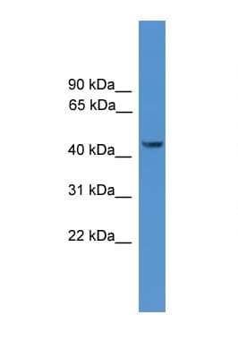 SYT12 / Synaptotagmin12 Antibody (aa71-120)
