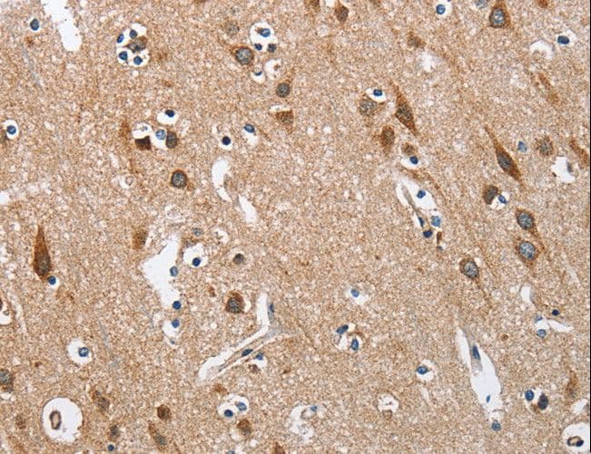 Polyclonal Rabbit anti-Human KLF7 Antibody (IHC)