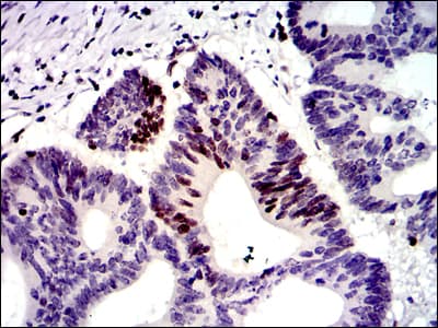 MSH6 Antibody (clone 30)