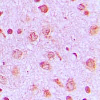 PFKP Antibody (Internal)